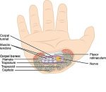 wrist-pain-relief-2