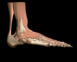 achilles tendon pain relief 1