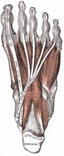 big toe pain